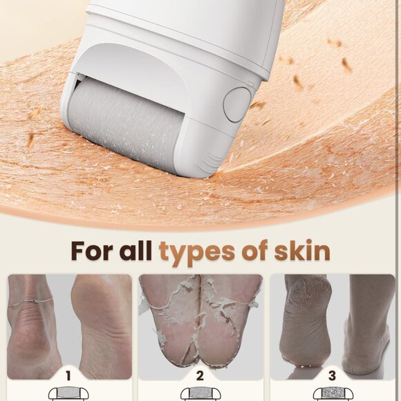 Electric Callus Remover for Feet - 2-Speed Rechargeable Pedicure Kit with 3 Roll - Picture 3 of 10